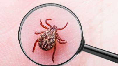 Ticks, and How To Remove Them!