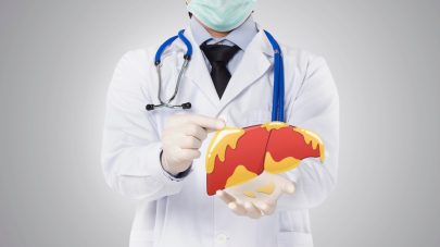 How to Support Liver Disease Naturally