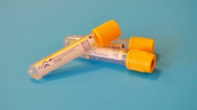 Does My Dog Need an Allergy Test?