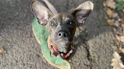 Cysteine Stones … Everything You Need to Know