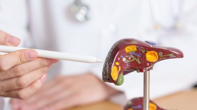 Can Diet Cause Raised Liver Enzymes?